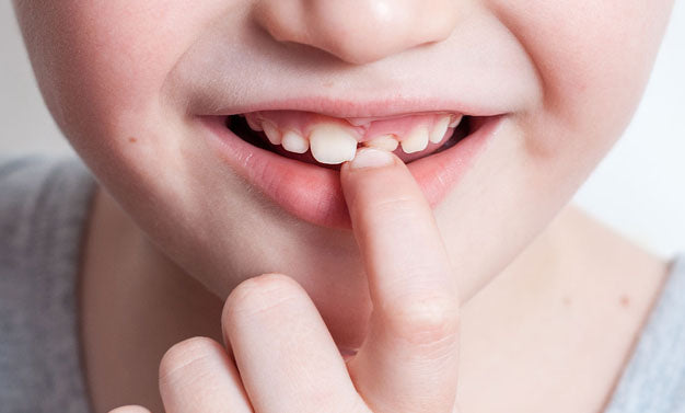Pourquoi les dents de lait se cassent et comment les protéger?