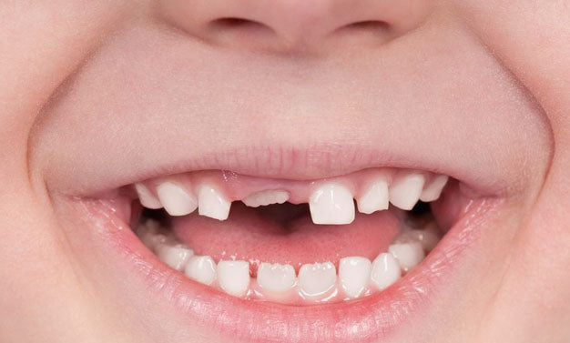 Pourquoi les dents permanentes sont-elles plus jaunes que les dents de lait ?