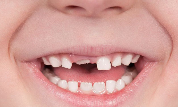 Quelles sont les dents de lait qui tombent et quand ?