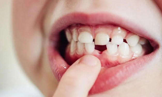 Comment savoir si les dents de bébé travaillent ?