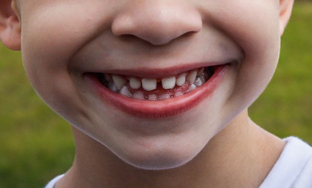 Conseils pour Embrasser vos "Dents du Bonheur" : Votre Sourire Unique
