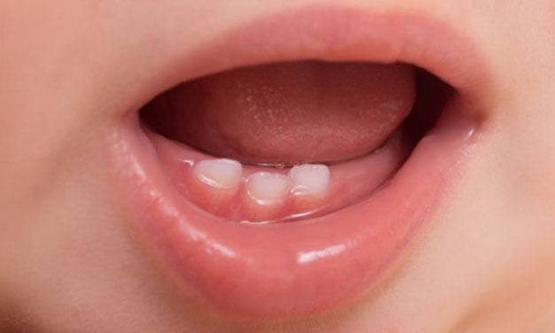 Comprendre le Sillon Gingival : La Clé d'une Bonne Santé Buccale